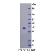 SDS-PAGE analysis of Human Angiotensinogen Protein.