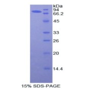 SDS-PAGE analysis of Human Angiotensinogen Protein.