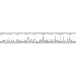 Human Apolipoprotein D (APOD) Protein