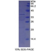 SDS-PAGE analysis of recombinant Human Apolipoprotein H Protein.