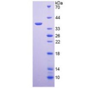 SDS-PAGE analysis of Mouse Arginase Protein.