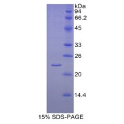 SDS-PAGE analysis of Human Aromatase Protein.