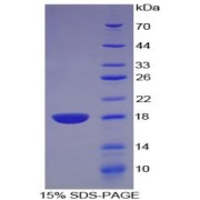 SDS-PAGE analysis of recombinant Rat Artemin Protein.