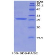 SDS-PAGE analysis of Mouse AXIN Protein.