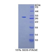 SDS-PAGE analysis of Human AXIN Protein.