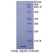 SDS-PAGE analysis of Human beta cellulin Protein.