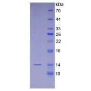 Human Beta-Lipotropic Hormone (bLPH) Protein