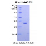 SDS-PAGE analysis of Rat bACE1 Protein.