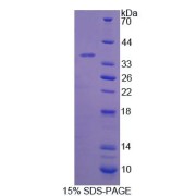 SDS-PAGE analysis of Rat beta Thromboglobulin Protein.