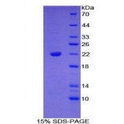 SDS-PAGE analysis of Mouse Bleomycin Hydrolase Protein.