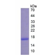 SDS-PAGE analysis of Human BLC1 Protein.