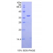 SDS-PAGE analysis of Mouse BLC1 Protein.