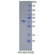 SDS-PAGE analysis of recombinant Mouse BMP1 Protein.