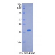 SDS-PAGE analysis of recombinant Rabbit Brain Derived Neurotrophic Factor BDNF Protein.