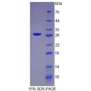 SDS-PAGE analysis of Rat C-Reactive Protein.