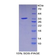 SDS-PAGE analysis of Mouse C2CD3 Protein.