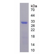 SDS-PAGE analysis of recombinant Human C4BPB Protein.