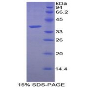 SDS-PAGE analysis of Human Calcineurin Protein.