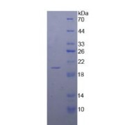 SDS-PAGE analysis of Human Calmodulin 1 Protein.