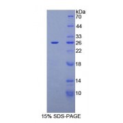 SDS-PAGE analysis of recombinant Human CA125 Protein.