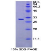 SDS-PAGE analysis of Chicken Carbonic Anhydrase II Protein.