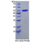 SDS-PAGE analysis of Human CA5B Protein.