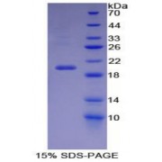 SDS-PAGE analysis of Mouse Carbonic Anhydrase VI Protein.