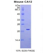SDS-PAGE analysis of CA12 Protein.