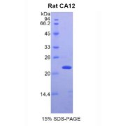 SDS-PAGE analysis of Rat CA12 Protein.