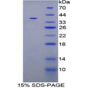 SDS-PAGE analysis of Rat CPB1 Protein.