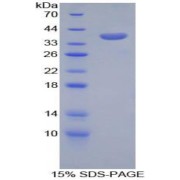 SDS-PAGE analysis of Mouse CPB1 Protein.