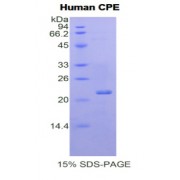 SDS-PAGE analysis of Human Carboxypeptidase E Protein.