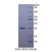 SDS-PAGE analysis of recombinant Human CEA Protein.