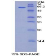 SDS-PAGE analysis of Human CILP Protein.