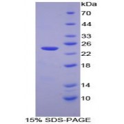 SDS-PAGE analysis of Human Caspase 7 Protein.