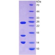 SDS-PAGE analysis of recombinant Human CAMP Protein.