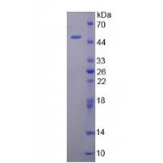SDS-PAGE analysis of Mouse CAMP Protein.