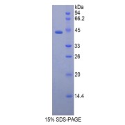 SDS-PAGE analysis of Rat CAMP Protein.