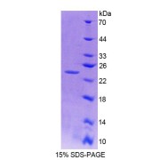 SDS-PAGE analysis of Human Cathepsin B Protein.