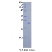 SDS-PAGE analysis of Rat Cathepsin B Protein.