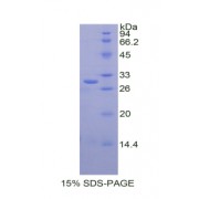 SDS-PAGE analysis of Human Cathepsin C Protein.