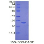 SDS-PAGE analysis of Rat Cathepsin G Protein.