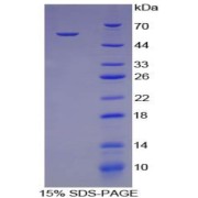 SDS-PAGE analysis of Pig Cathepsin K Protein.