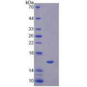 SDS-PAGE analysis of recombinant Human Caveolin 1 Protein.