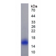 SDS-PAGE analysis of recombinant Rat Caveolin 1 Protein.