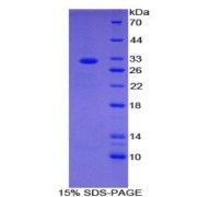 SDS-PAGE analysis of Human CIDEC Protein.