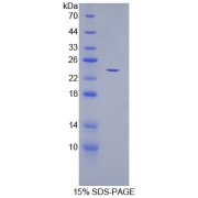 SDS-PAGE analysis of Human CDC25B Protein.