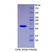 SDS-PAGE analysis of Human Centromere Protein E Protein.