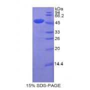 SDS-PAGE analysis of recombinant Human CDNF Protein.