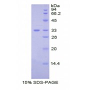 SDS-PAGE analysis of Human Ceruloplasmin Protein.